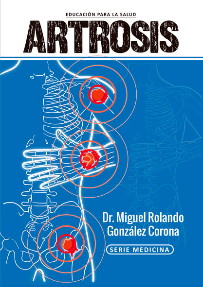 Artrosis. (Ebook)