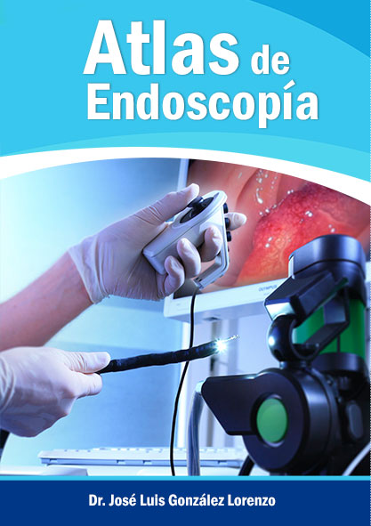Atlas de endoscopía. (Ebook y Multimedia)